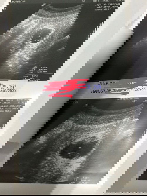 ซาวด์ 8w ขนาด ปกติไหมคะ