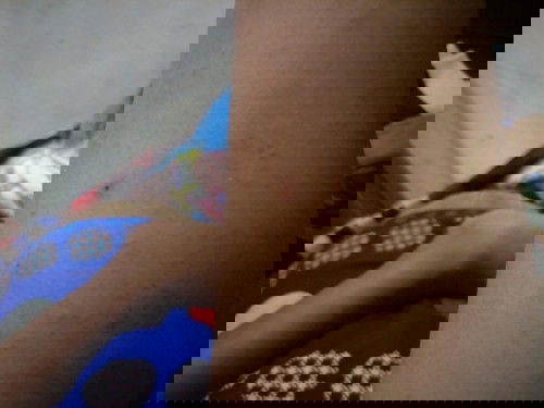 Mau tanya donk bun aku hamil 5 bulan dari usia 1 mnggu smpai sekarang sering gatal2 d badan apa obat