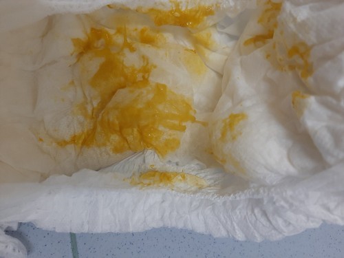 น้องถ่ายเป็นมูกแบบนี้เป็นอะไรไหมค่ะ