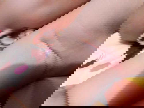 ruam miss V & ketiak merah