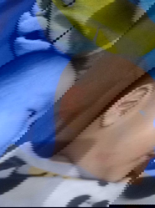 kemerahan pada kulit