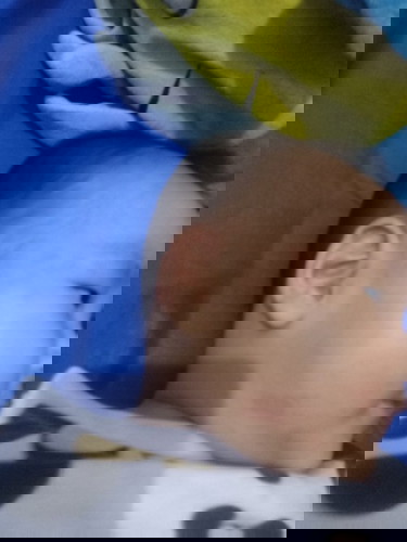 kemerahan pada kulit