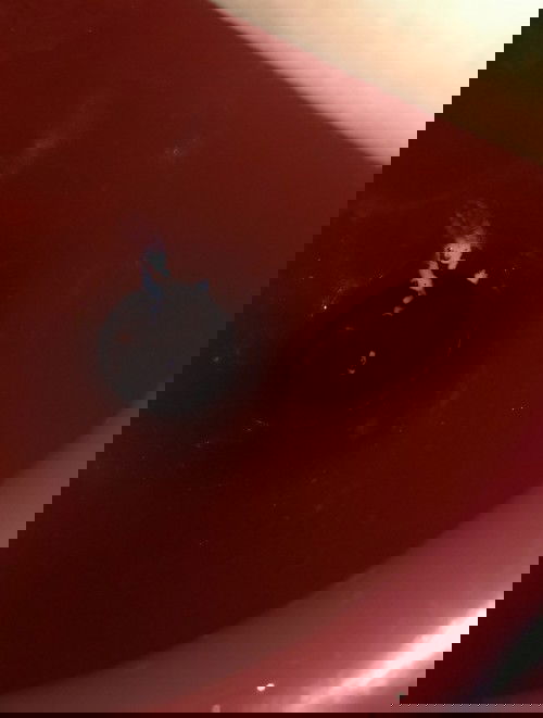 มีตกขาวสีขาวขุ่นเหมือนแป้งเปียก 38+2วีค