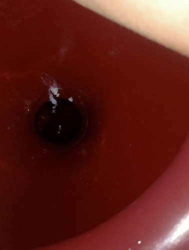 มีตกขาวสีขาวขุ่นเหมือนแป้งเปียก 38+2วีค