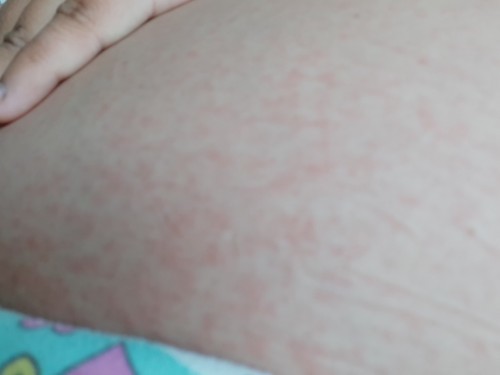 ขอถามแม่ๆๆหน่อยค่ะ