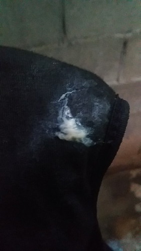 มีแบบนี้ออกมาปกติมั้ยคะ