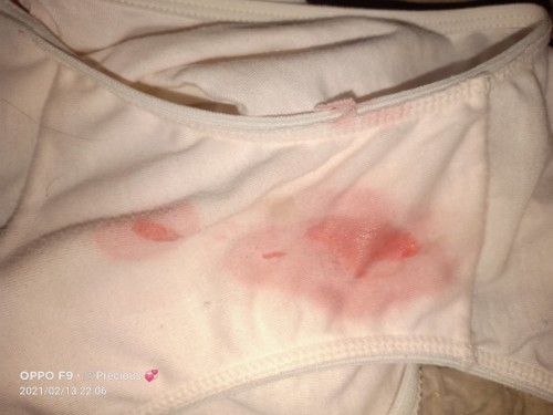 Bleeding and cramps