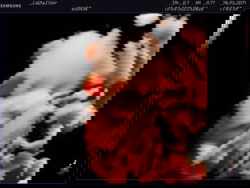 Happy Valentine's Day นะคะแม่ๆ