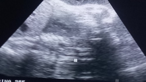 Name for my little Girlπ