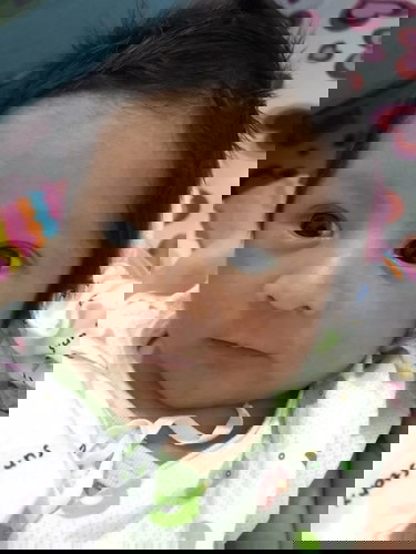 ลูกตาเหลือง ทำไงดีค่ะ