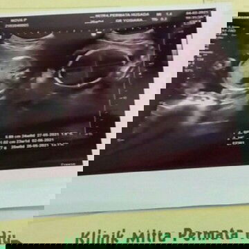 Bund mau tanya aku kan sekarang hamil 6bulan lebih hpl mei tgl 15 kemaren baru aja aku usg dan kata