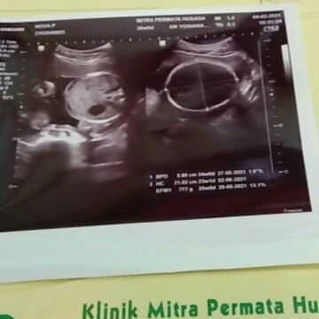 Bund mau tanya aku kan sekarang hamil 6bulan lebih hpl mei tgl 15 kemaren baru aja aku usg dan kata