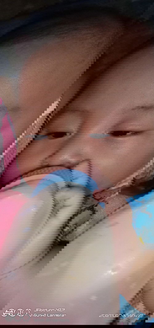 Bintik merah dipipi dan mata