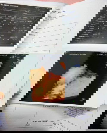 PENGALAMAN SEMAKIN MENCABAR!!!!!KANDUNGAN TERAKHIR HARAPAN TERAKHIR LEBUH BANYAK DUGAAN.