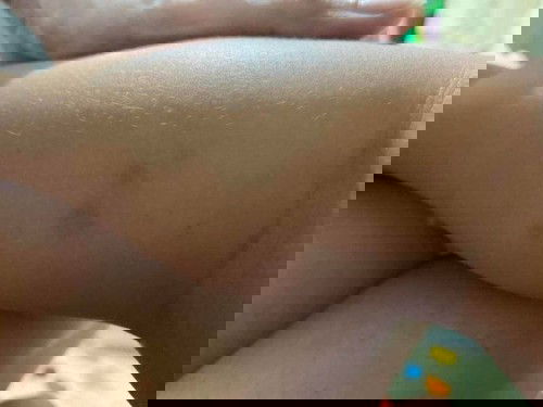 Kulit Sensitif atau Autoimun?