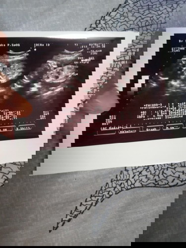 Alhamdulillah sehat π€²