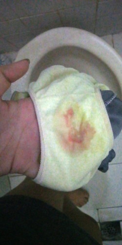 Normal lang po ba? 5months and half