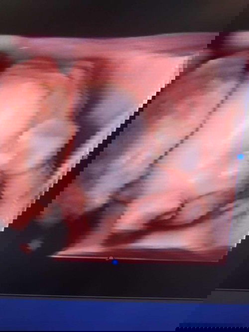 Dede cenut sudah besar🥰