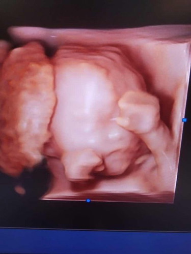 Dede cenut sudah besar🥰