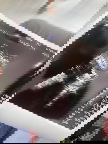 แม่บ้านอื่นลูก 26 week หนักเท่าไหร่กันบ้างคะ 🥰