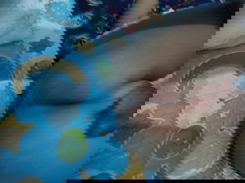 Hilangkan merah pada pantat