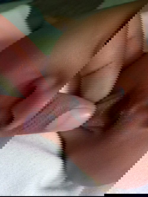 Bintik putih di bibir