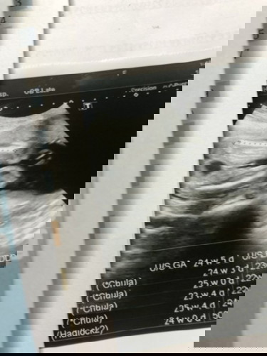 เจ้าตัวน้อยของเเม่😍😍