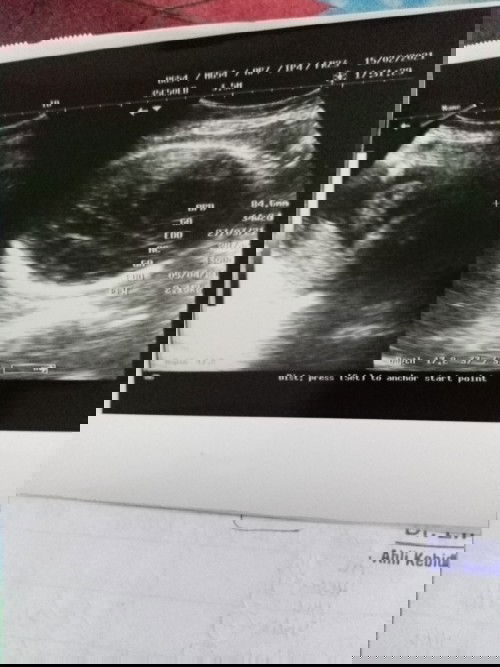 Hasil usg tadi sore