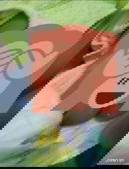 PUP baby 4 bulan bergerinjil ( mau pintar/diare)