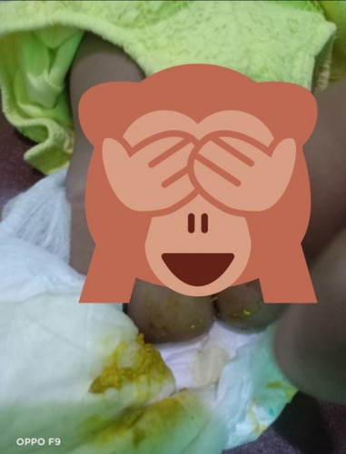 PUP baby 4 bulan bergerinjil ( mau pintar/diare)