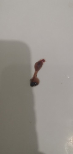 10 weeks pregnant Discharge