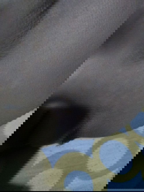 Bintik putih seperti panu