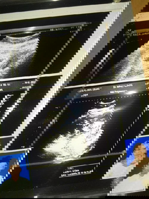 Cinta monyet, LDR hingga menikah dan hamil.