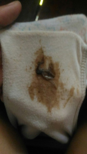 chocolate discharge