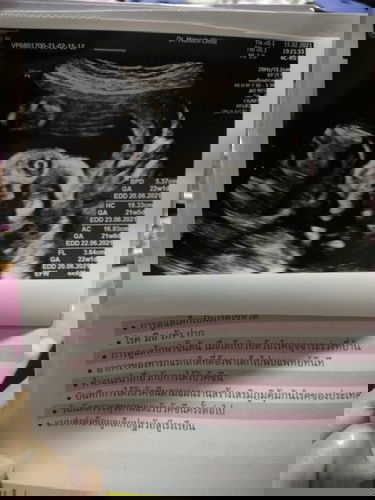 ช่วยดูหน่อยค่ะ ญ หรือ ช 🥰🥰
แต่คุณหมอบอกลูกสาวส่วนตัวมองไม่ออกค่ะ(ขอบคุณค่ะ)