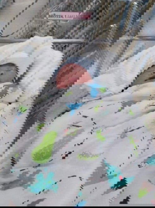 แชร์ประสบการณ์กึ่งคลอดธรรมชาติกึ่งผ่าคลอด​ แบบยาววมากกกกก