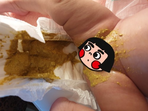 ท้องเสียรึเปล่า?