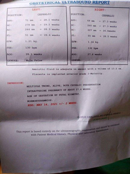 HI MAY ASK LANG PO AKO 😊