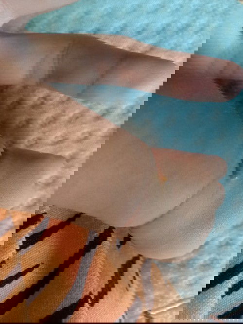 โดนยุงกัด