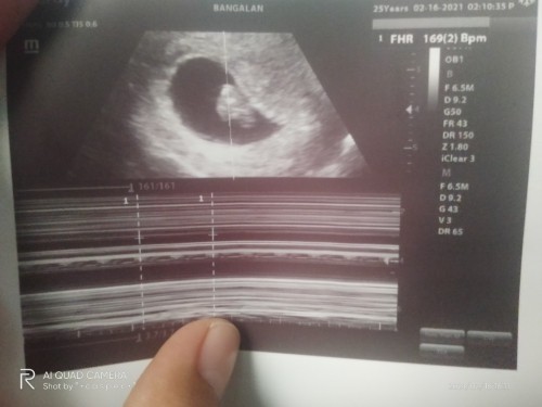 Hello little bean . π₯°