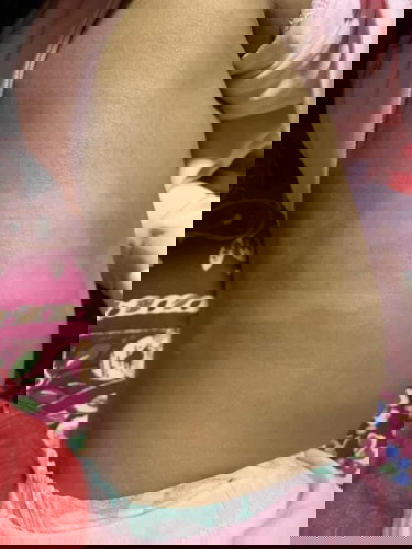 White patches