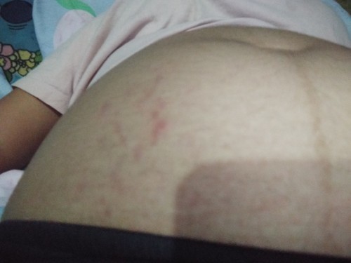 แม่ๆคนไหนเป็นบ้าง