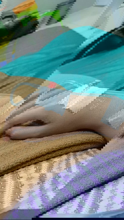 Flek yg akhirnya harus d kuret