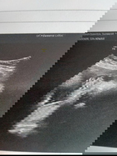 39+2ทีมกุมพาจร้า..