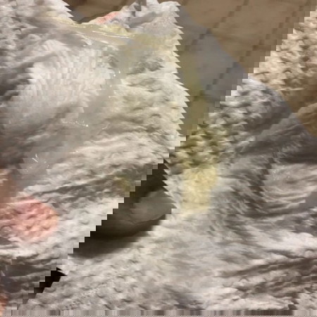 ตกขาวแบบนี้อันตรายไหม