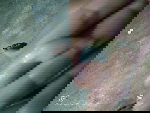 มีแบบนี้ออกมาต้องไปหาหมอมั้ยค่ะใช่มูกใสไหมค่ะแบบนี้