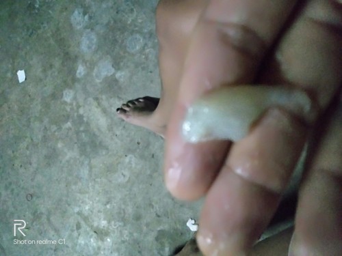 มีแบบนี้ออกมาต้องไปหาหมอมั้ยค่ะใช่มูกใสไหมค่ะแบบนี้