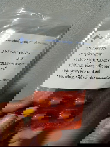 ตั้งครรณ์ท้องแรก