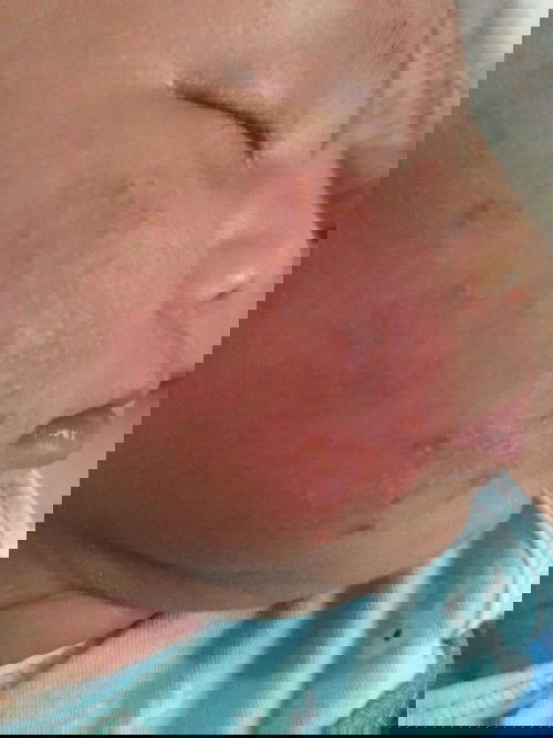 แนะนำยาหน่อยค่ะ