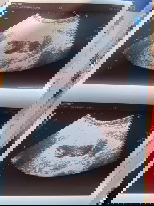 #ลูกแฝด ดูแลยากมั้ยคะ